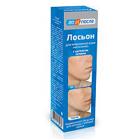 Маска с крахмала для лица черные точки